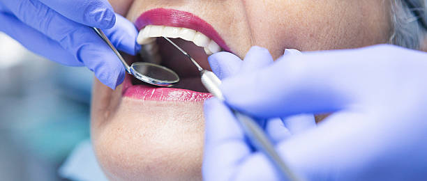 Best Urgent Care for Lost Fillings or Crowns in Wchester, IN